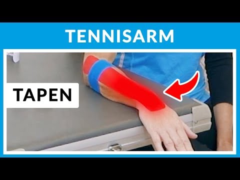 Tennisellenbogen / Tennisarm Kinesio-Tape + Übungen (Teil 2)